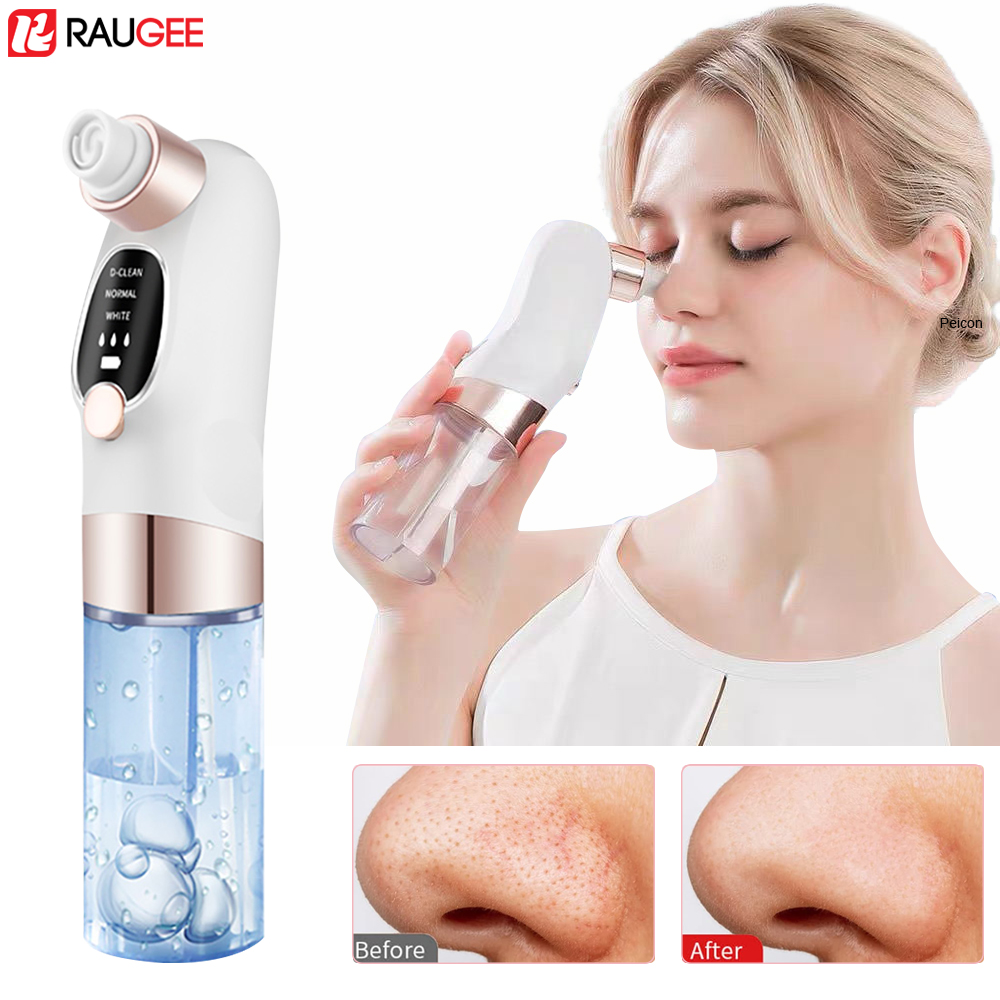 Air Bubble Remover - Электрический экстрактор черных точек, пылесос для